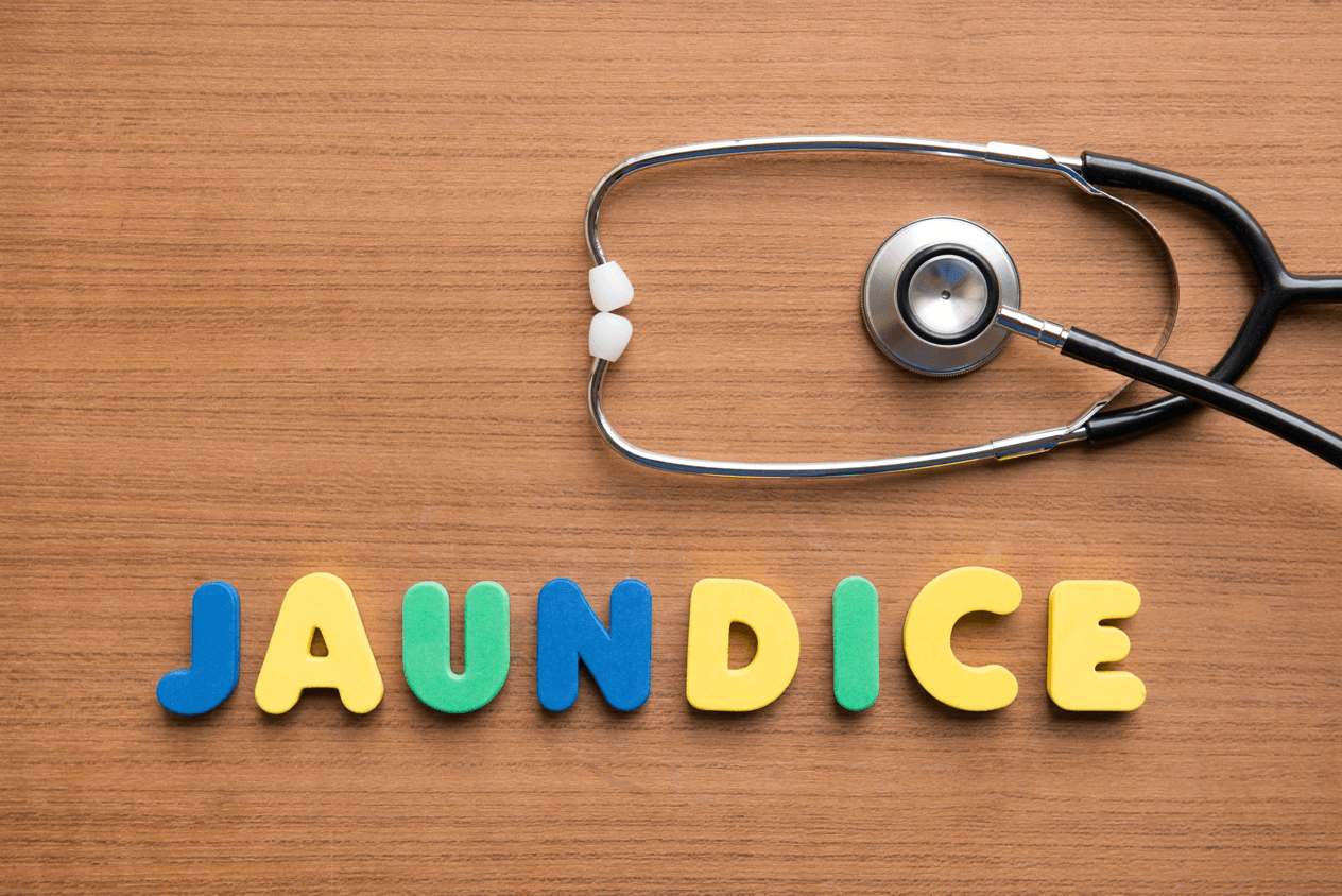 Jaundice Turning Yellow